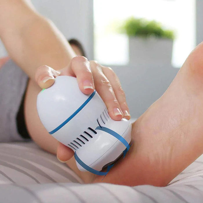 CleanFeet™ Elektrische Eeltverwijderaar
