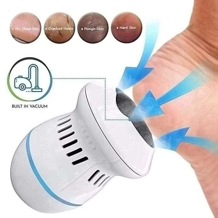 CleanFeet™ Elektrische Eeltverwijderaar