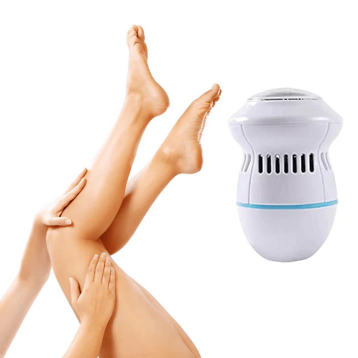 CleanFeet™ Elektrische Eeltverwijderaar