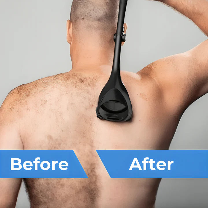 BackRazor™ Voor het scheren van rughaar | Tijdelijk 50% korting